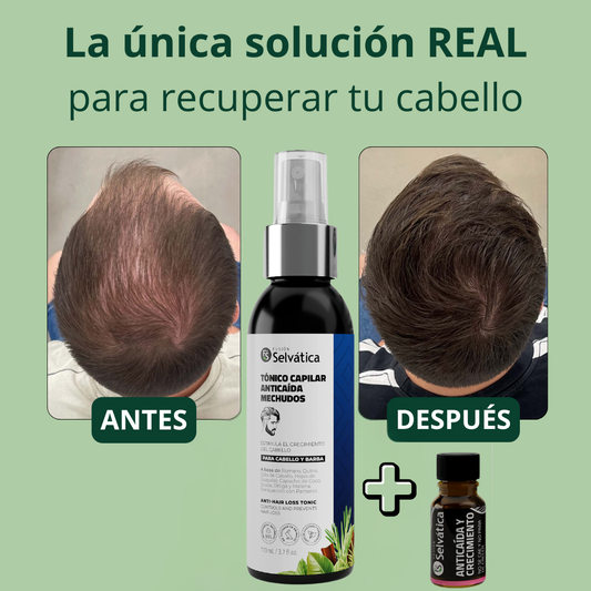 Recupera tu cabello con Selvática en 90 días -Tónico + Ampolleta Anticaída y crecimiento ¡OFERTA LIMITADA 50%
